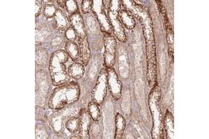 Immunohistochemical staining of human kidney with ZNF623 polyclonal antibody  shows distinct cytoplasmic positivity in distal tubules at 1:20-1:50 dilution. (ZNF623 anticorps)