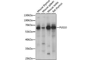 Western blot analysis of extracts of various cell lines, using PUS10 antibody (ABIN7269738) at 1000 dilution. (PUS10 anticorps  (AA 290-529))