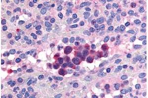 Human Spleen (formalin-fixed, paraffin-embedded) stained with PDE9A antibody ABIN213537 at 20 ug/ml followed by biotinylated goat anti-rabbit IgG secondary antibody ABIN481713, alkaline phosphatase-streptavidin and chromogen. (PDE9A anticorps  (Internal Region))