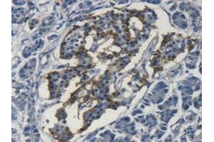 Detection of SOD3 in Human Pancreas Tissue using Polyclonal Antibody to Superoxide Dismutase 3, Extracellular (SOD3)