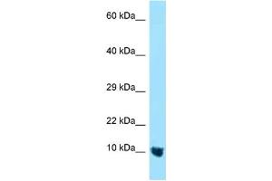 WB Suggested Anti-MTCP1NB Antibody Titration: 1. (CMC4 anticorps  (N-Term))