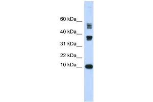 FABP3 antibody used at 1 ug/ml to detect target protein. (FABP3 anticorps)