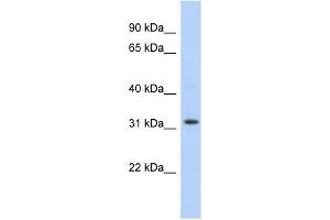 C1ORF131 antibody used at 1 ug/ml to detect target protein. (C1orf131 anticorps  (Middle Region))