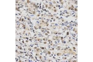 Immunohistochemistry (IHC) image for anti-Small Nuclear Ribonucleoprotein Polypeptide E (SNRPE) antibody (ABIN1876676) (SNRPE anticorps)