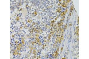 Immunohistochemistry of paraffin-embedded Rat spleen using TRAF3IP2 Polyclonal Antibody at dilution of 1:100 (40x lens). (TRAF3IP2 anticorps)