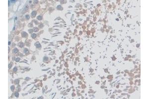 Detection of MYO1D in Rat Testis Tissue using Polyclonal Antibody to Myosin ID (MYO1D) (Myosin ID anticorps  (AA 512-788))