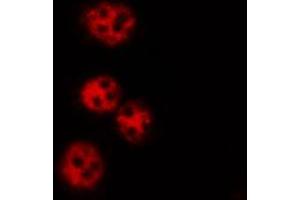 ABIN6269061 staining K562 by IF/ICC.