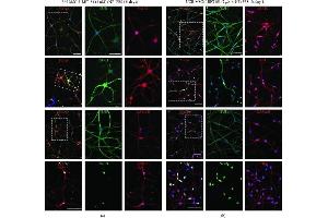 Presence of mature neuronal markers after induction with ICFRYA plus neurotrophic factors and FBS in UCB- and BM-MSCs. (MAPT anticorps  (N-Term))