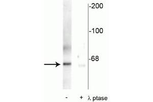Western blot of rat synaptic membrane showing specific immunolabeling of the ~66 kDa PLK protein phosphorylated at Thr210 in the first lane (-). (PLK1 anticorps  (pThr210))