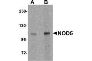 Western blot analysis of NOD5 in rat spleen tissue cell lysate with NOD5 antibody at (A) 1 and (B) 2 μg/ml. (NLRX1 anticorps  (N-Term))