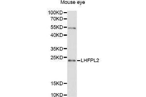 Western blot analysis of extracts of mouse eye, using LHFPL2 antibody (ABIN6294117) at 1:3000 dilution. (LHFPL2 anticorps)