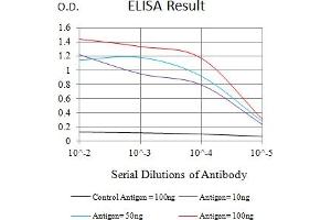 Black line: Control Antigen (100 ng),Purple line: Antigen (10 ng), Blue line: Antigen (50 ng), Red line:Antigen (100 ng)