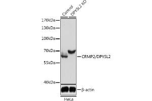 Western blot analysis of extracts from normal (control) and CRMP2/CRMP2/DPYSL2 knockout (KO) HeLa cells, using CRMP2/CRMP2/DPYSL2 antibody (ABIN7266769) at 1:3000 dilution.