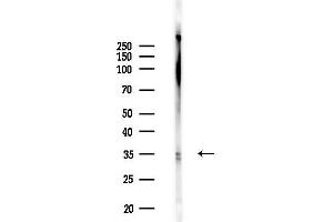Western blot analysis of lysates from F10-LUC cells(UV,30 min treatment), using SC35 Antibody at 1/1000 dilution.