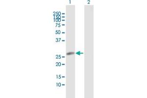 Western Blot analysis of HLA-DRB5 expression in transfected 293T cell line by HLA-DRB5 MaxPab polyclonal antibody.
