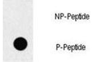 Dot blot analysis of p-EGFR antibody. (EGFR anticorps  (pTyr1069))