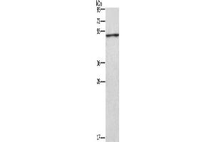 Western Blotting (WB) image for anti-Creatine Kinase, Mitochondrial 2 (Sarcomeric) (CKMT2) antibody (ABIN2429793) (CKMT2 anticorps)