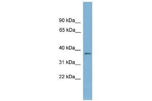 Western Blot showing NUBP1 antibody used at a concentration of 1-2 ug/ml to detect its target protein. (NUBP1 anticorps  (Middle Region))