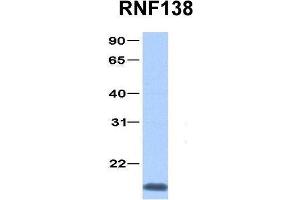 Host:  Rabbit  Target Name:  RNF138  Sample Type:  Jurkat  Antibody Dilution:  1. (RNF138 anticorps  (C-Term))