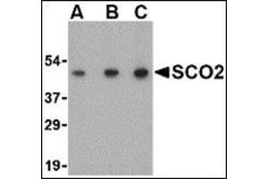 Western blot analysis of SCO2 in human liver tissue lysate with this product at (A) 0. (SCO2 anticorps  (C-Term))