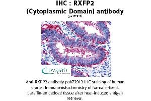 Image no. 1 for anti-Relaxin/insulin-Like Family Peptide Receptor 2 (RXFP2) (2nd Cytoplasmic Domain) antibody (ABIN1738984) (RXFP2 anticorps  (2nd Cytoplasmic Domain))