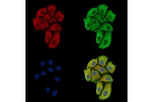 ABIN7097182 and ABIN7101250 staining Hela cells by IF/ICC. (FAM122B anticorps)