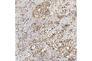 IHC analysis of SNRNP27 using anti-SNRNP27 antibody (ABIN7599614). (SNRNP27 anticorps  (AA 100-155))