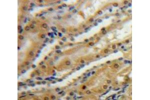 IHC-P analysis of Kidney tissue, with DAB staining. (SPARC anticorps  (AA 18-303))
