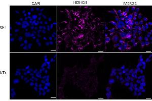 Immunocytochemical staining of HeLa cells using HDHD5 antibody (ABIN7798836), 1:1,000), Top panel: wild-type (WT), Bottom panal: HDHD5 shRNA knockdown (KD). (Recombinant Haloacid Dehalogenase-Like Hydrolase Domain-Containing 5 (HDHD5) anticorps)