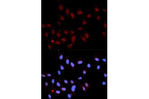 Immunofluorescence analysis of U2OS cell using Phospho-Stat3-Y705 antibody. (STAT3 anticorps  (pTyr705))