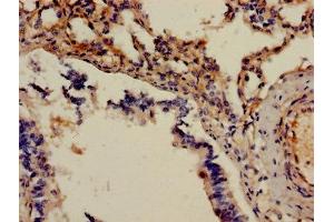 Immunohistochemistry of paraffin-embedded human lung tissue using ABIN7143430 at dilution of 1:100 (Adrenomedullin anticorps  (AA 45-92))
