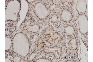 Immunoperoxidase of monoclonal antibody to RCC1 on formalin-fixed paraffin-embedded human thyroid nodular goiter. (RCC1 anticorps  (AA 312-421))