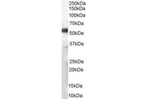 Image no. 2 for anti-CD14 (CD14) (Internal Region) antibody (ABIN374645) (CD14 anticorps  (Internal Region))