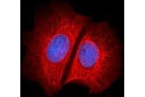 Immunofluorescence (IF) image for anti-Keratin 1 (KRT1) antibody (Alexa Fluor 647) (ABIN2657196) (Cytokeratin 1 anticorps  (Alexa Fluor 647))