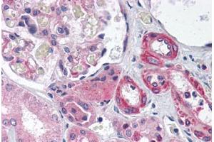 anti-GIPC PDZ Domain Containing Family, Member 1 (GIPC1) (AA 40-89) antibody