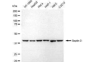 Western blotting analysis using Septin 2 antibody (ABIN7800295). (Recombinant Septin 2 anticorps)