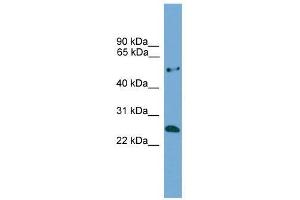Western Blot showing ETHE1 antibody used at a concentration of 1-2 ug/ml to detect its target protein. (ETHE1 anticorps  (Middle Region))