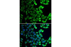 Immunofluorescence analysis of U20S cell using UIMC1 antibody.