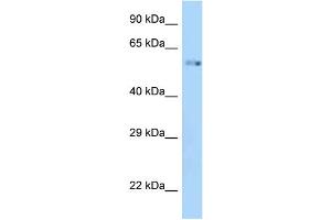 WB Suggested Anti-Zik1 Antibody Titration: 1.