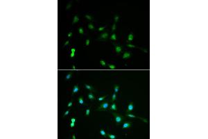 Immunofluorescence analysis of A549 cells using PIWIL4 antibody (ABIN5971612). (PIWIL4 anticorps)