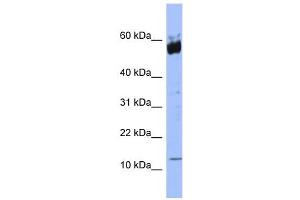 WB Suggested Anti-S100A9 Antibody Titration: 0. (S100A9 anticorps  (N-Term))