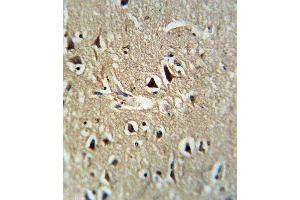 Formalin-fixed and paraffin-embedded human brain tissue reacted with PCSK2 Antibody (Center), which was peroxidase-conjugated to the secondary antibody, followed by DAB staining.