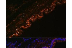 Immunofluorescence analysis of Rat lung cells using SCNN1A Polyclonal Antibody at dilution of 1:100. (SCNN1A anticorps)