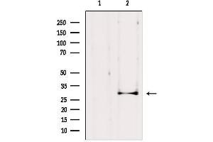 Western blot analysis of extracts from HepG2, using AQP1 Antibody. (Aquaporin 1 anticorps  (Internal Region))