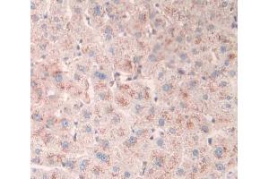 Used in DAB staining on fromalin fixed paraffin- embedded liver tissue