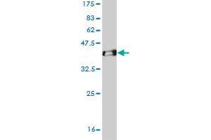 Western Blot detection against Immunogen (37. (OTX1 anticorps  (AA 10-116))