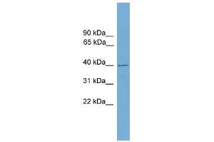 FBXO31 antibody used at 0. (FBXO31 anticorps  (Middle Region))