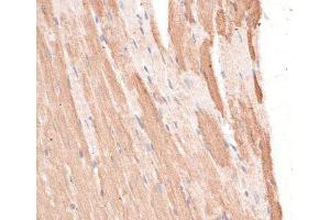 Immunohistochemistry of paraffin-embedded Mouse heart using KIF1C Polyclonal Antibody at dilution of 1:100 (40x lens). (KIF1C anticorps)