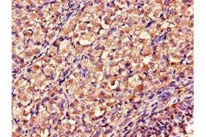 Immunohistochemistry of paraffin-embedded human ovarian tissue using ABIN7160797 at dilution of 1:100 (DDAH2 anticorps  (AA 1-285))