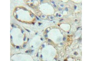 Used in DAB staining on fromalin fixed paraffin-embedded kidney tissue (Ephrin A5 anticorps  (AA 21-203))